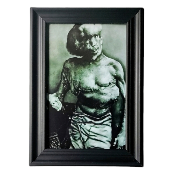 elephant man john merrick Freakshow Sideshow Carnival Circus Oddity Framed Photo - Picture 2 of 3